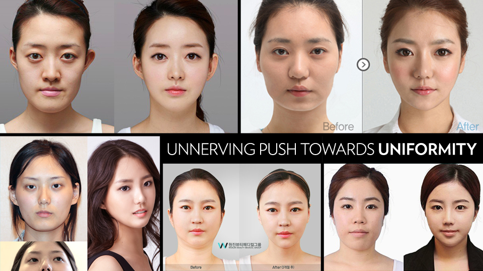 한국 여성에게, 성형수술은 도대체 무엇인가?